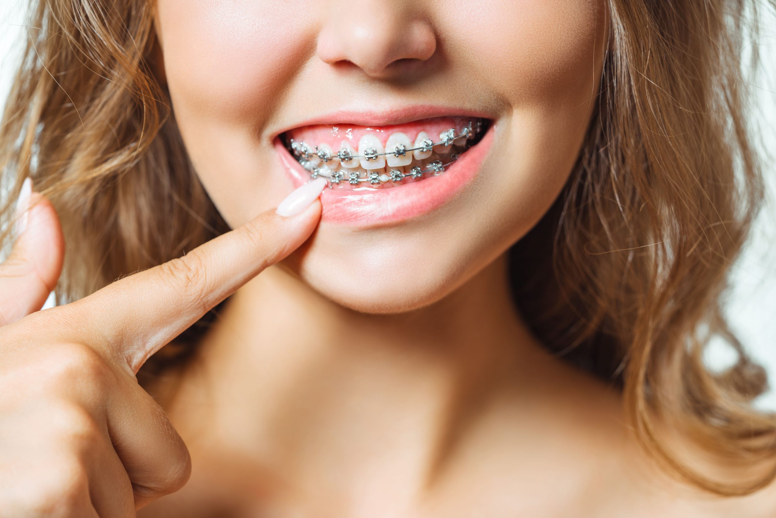 close up portrait of young cheerful readhead woman at orthodontist scaled